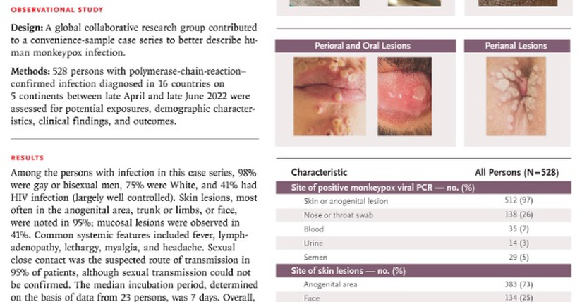 Monkeypox Virus Infection in Humans across 16 Countries — April–June 2022